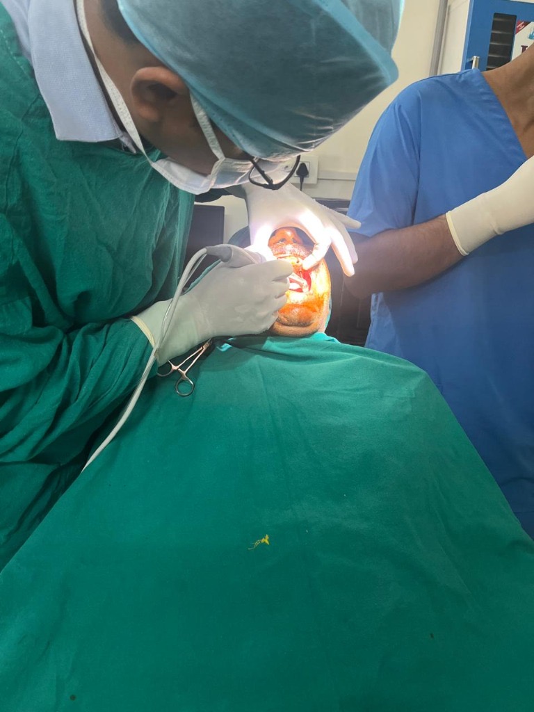 Dr. Vikramjeet performing oral surgery at hospital in Rohtak